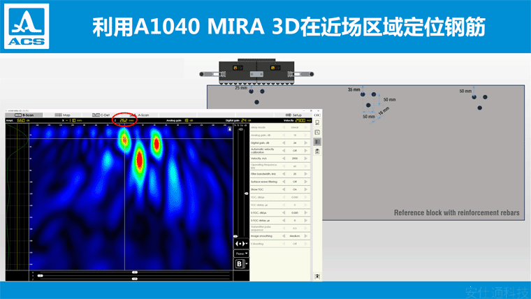 超声波断层扫描仪使用指南:解答常见问题,学会如何使用 超声波断层扫描仪使用指南:解答常见问题,学会如何使用